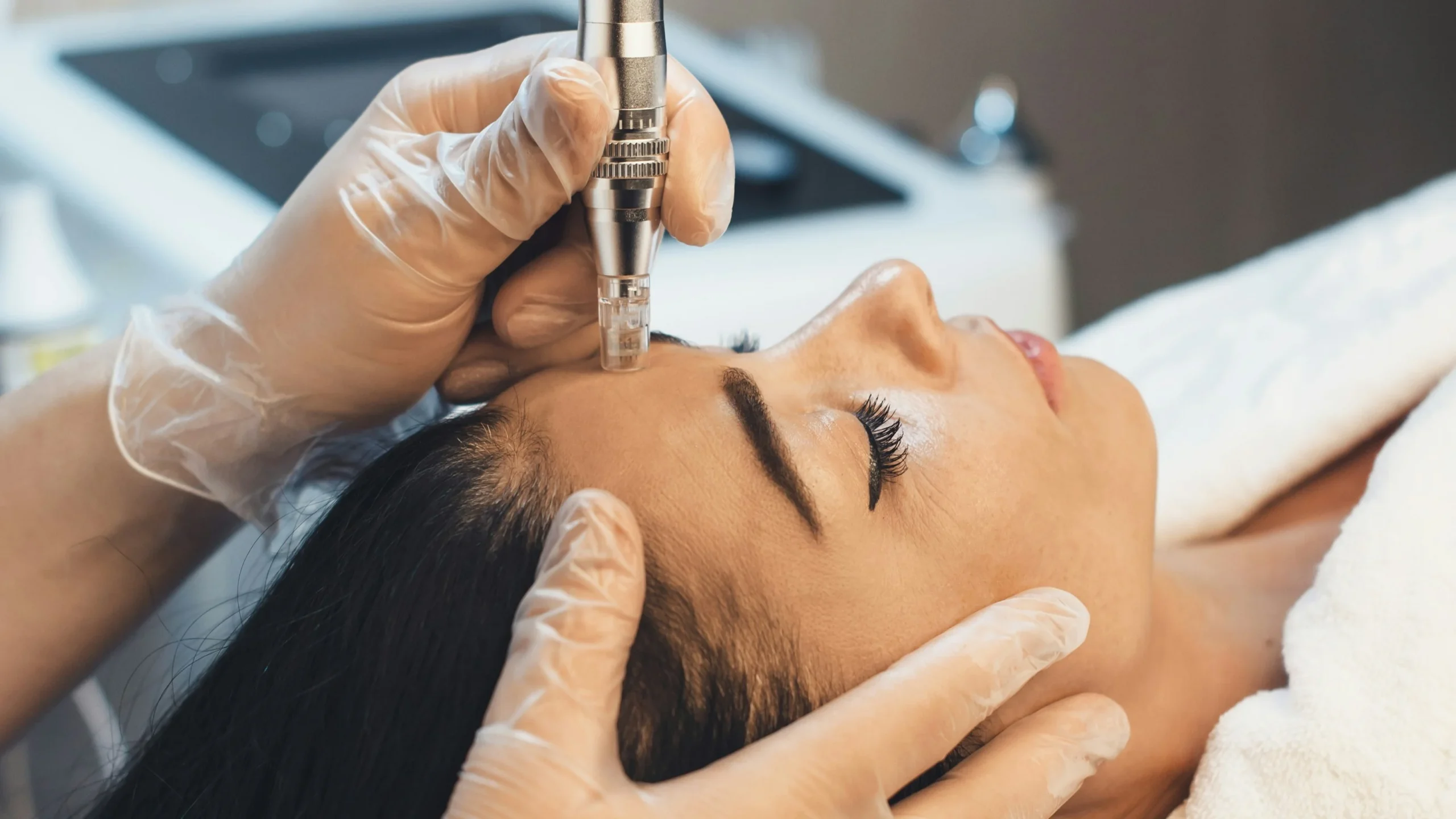 How Microneedling Supports Collagen Production For Smoother And Firmer Skin