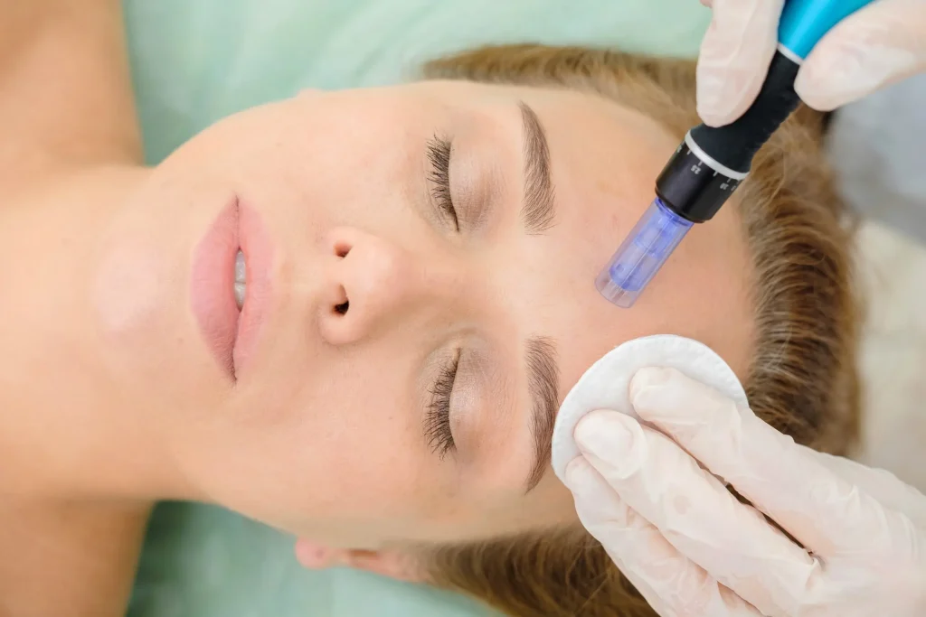 microneedling bangkok